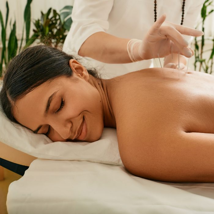 acupuncture by infinite life medical (1)